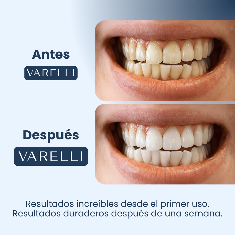 Varelli™ – 14 Tiras Blanqueadoras Violetas