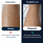 Toalla de ducha exfoliante antibacteriana